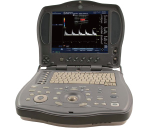 腹部超音波装置のイメージ