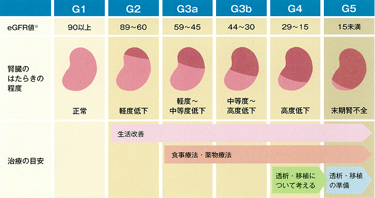 CKDの病期一覧