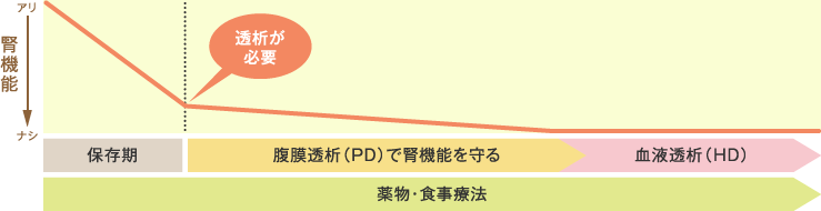 「PDファースト」のイメージ